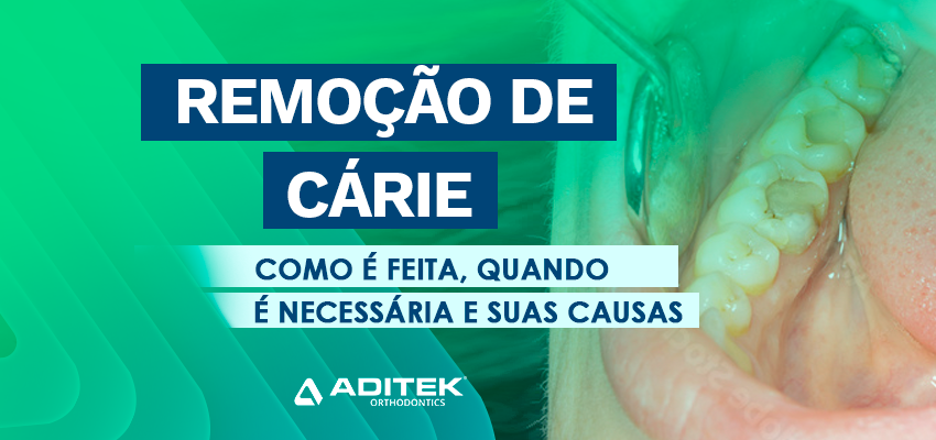 Remoção de cárie