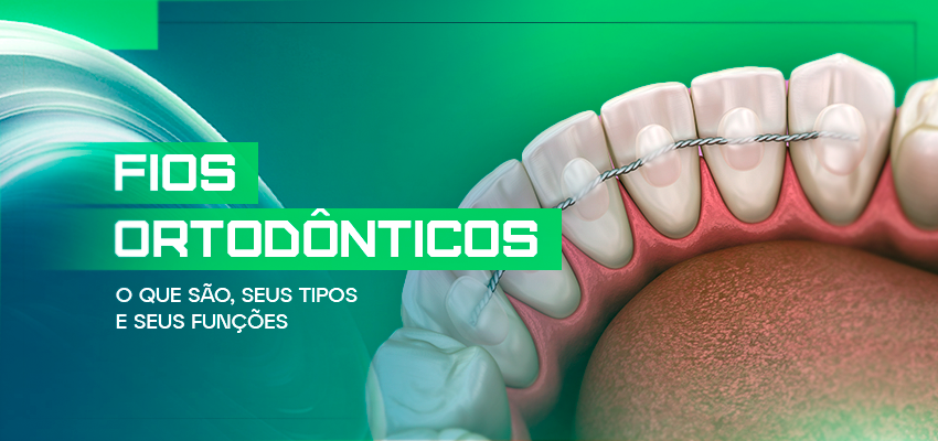 O que são fio sortodônticos