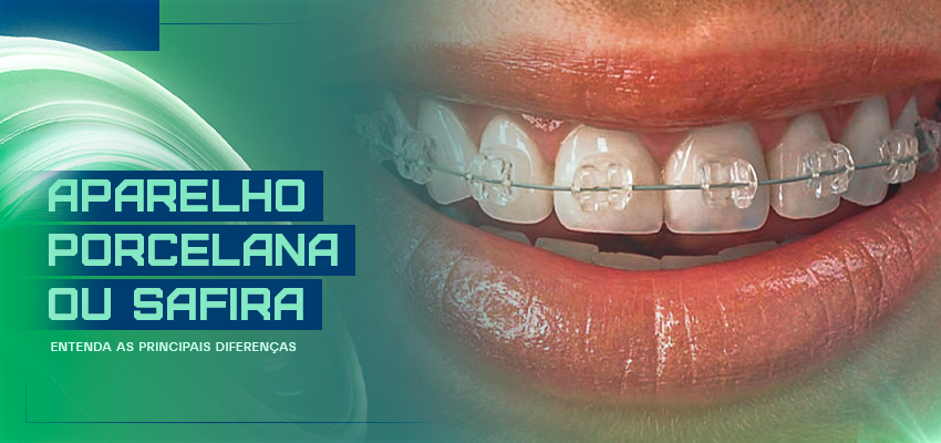 Aparelho porcelana ou safira