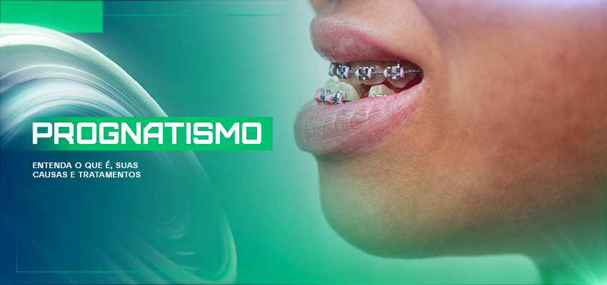Prognatismo