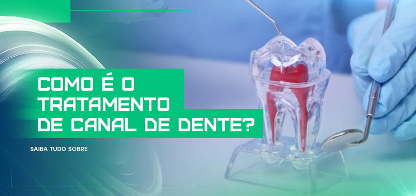 tratamento de canal de dente