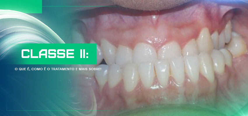 Classe II