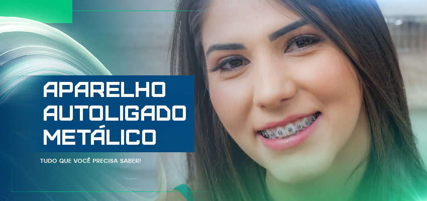 Aparelho autoligado metálico