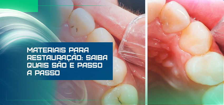 Materiais para restauração