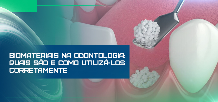 Biomateriais na odontologia