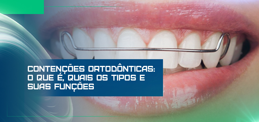 Contenções ortodônticas: o que é