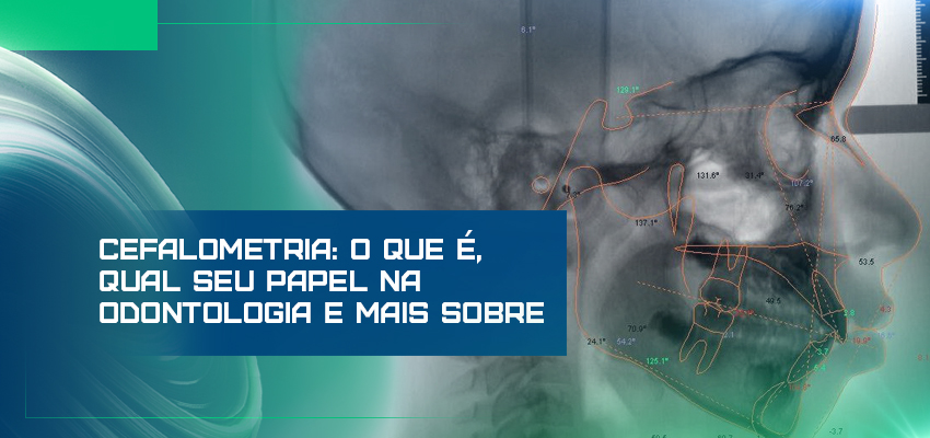 Cefalometria: o que é