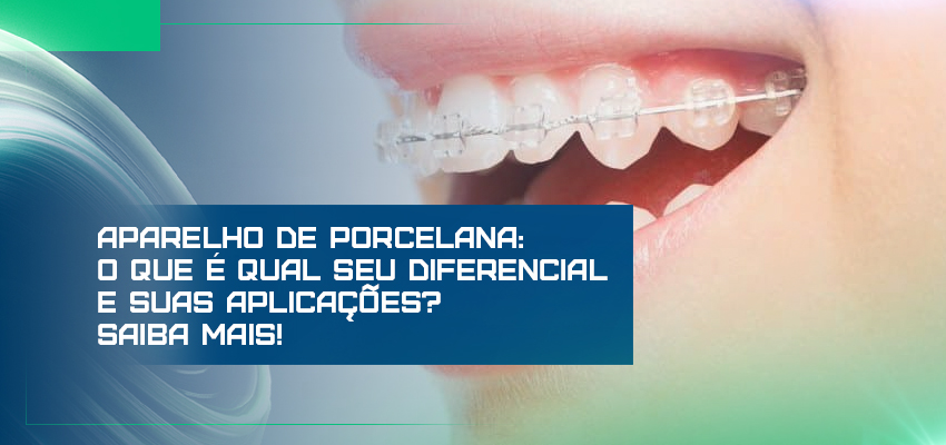 Aparelho de porcelana