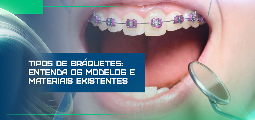 Tipos de Bráquetes