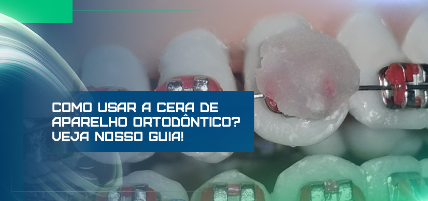 Cera de aparelho ortodôntico