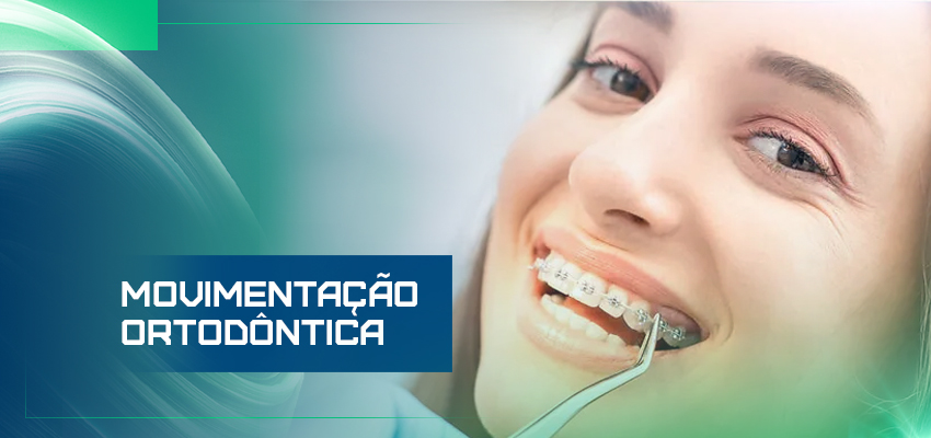 Movimentação ortodontica