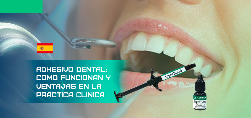 Adhesivos dentales
