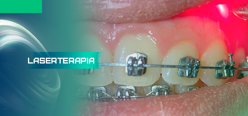 Laserterapia