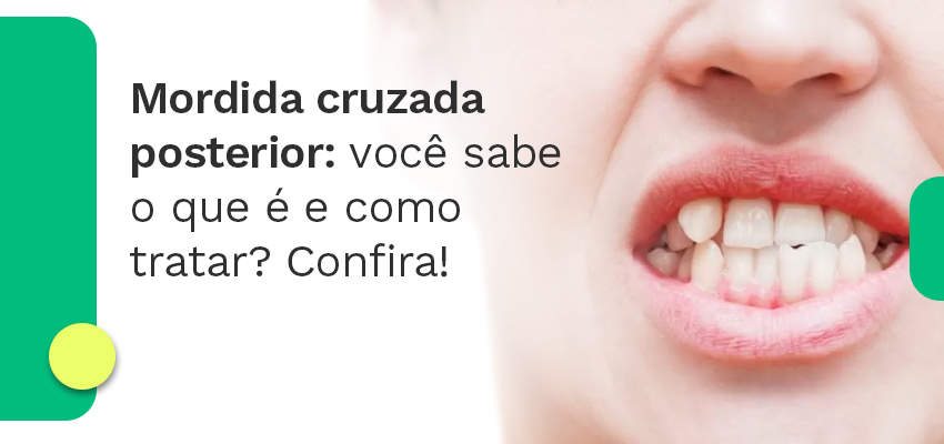 Mordida cruzada posterior