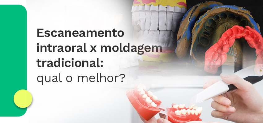Escaneamento intraoral x moldagem tradicional