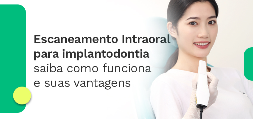 Escaneamento Intraoral para implantodontia