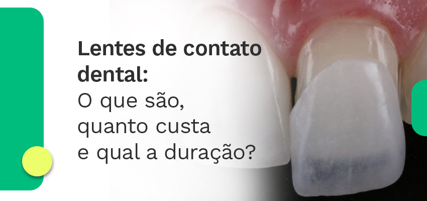 Lentes de contato dental