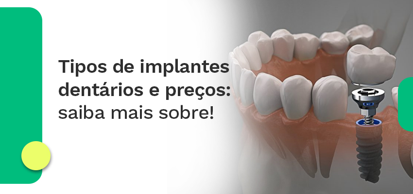 Tipos de implantes dentários