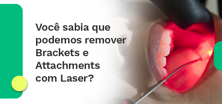 Você sabia que podemos remover Brackets e Attachments com Laser?