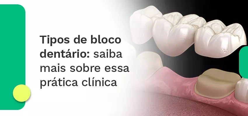 Tipos de coroas dentárias