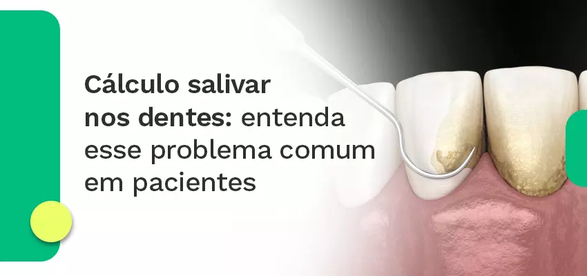 Cálculo Salivar nos Dentes