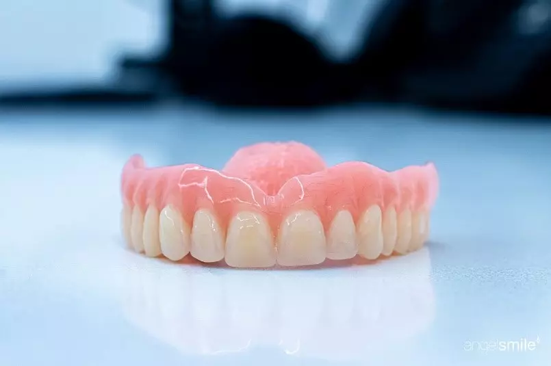 Vantagens da prótese dentária removível com encaixe