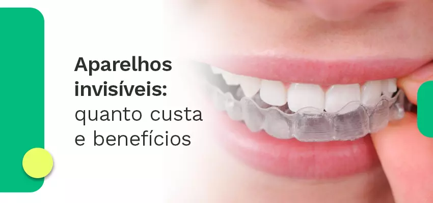 Aparelhos invisíveis