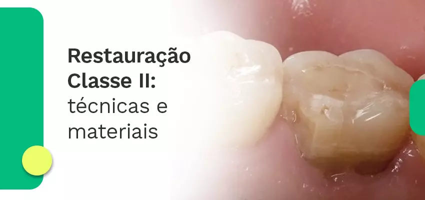 Restauração classe ii