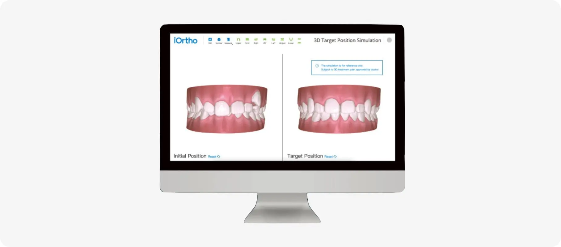 Planejamento do tratamento por meio de software especializado