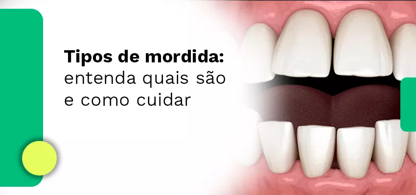 Tipos de mordida