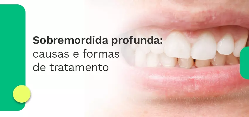 Sobremordida profunda