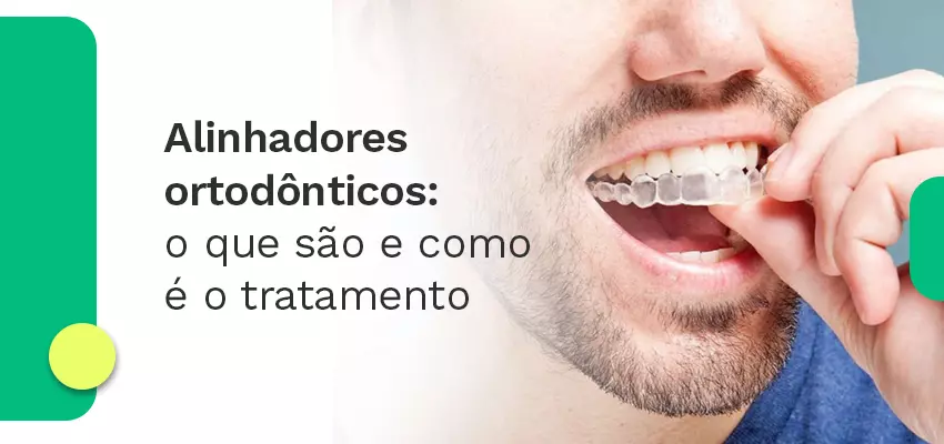 Alinhadores ortodônticos