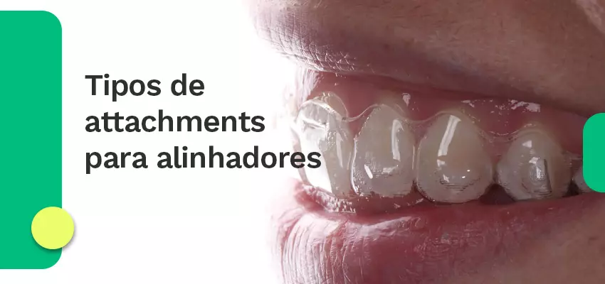 Tipos de attachments para alinhadores