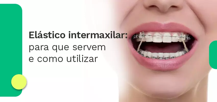Elástico intermaxilar
