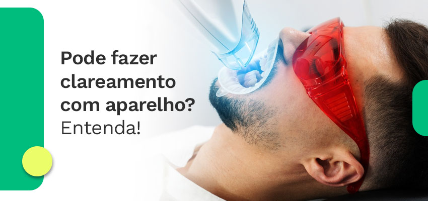 Pode fazer clareamento com aparelho